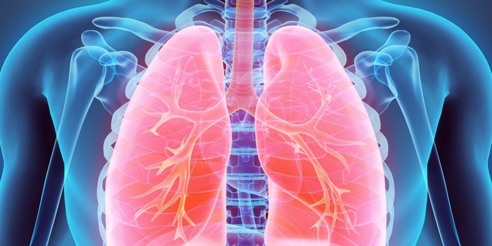“Wet lung”