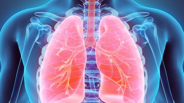 “Wet lung”